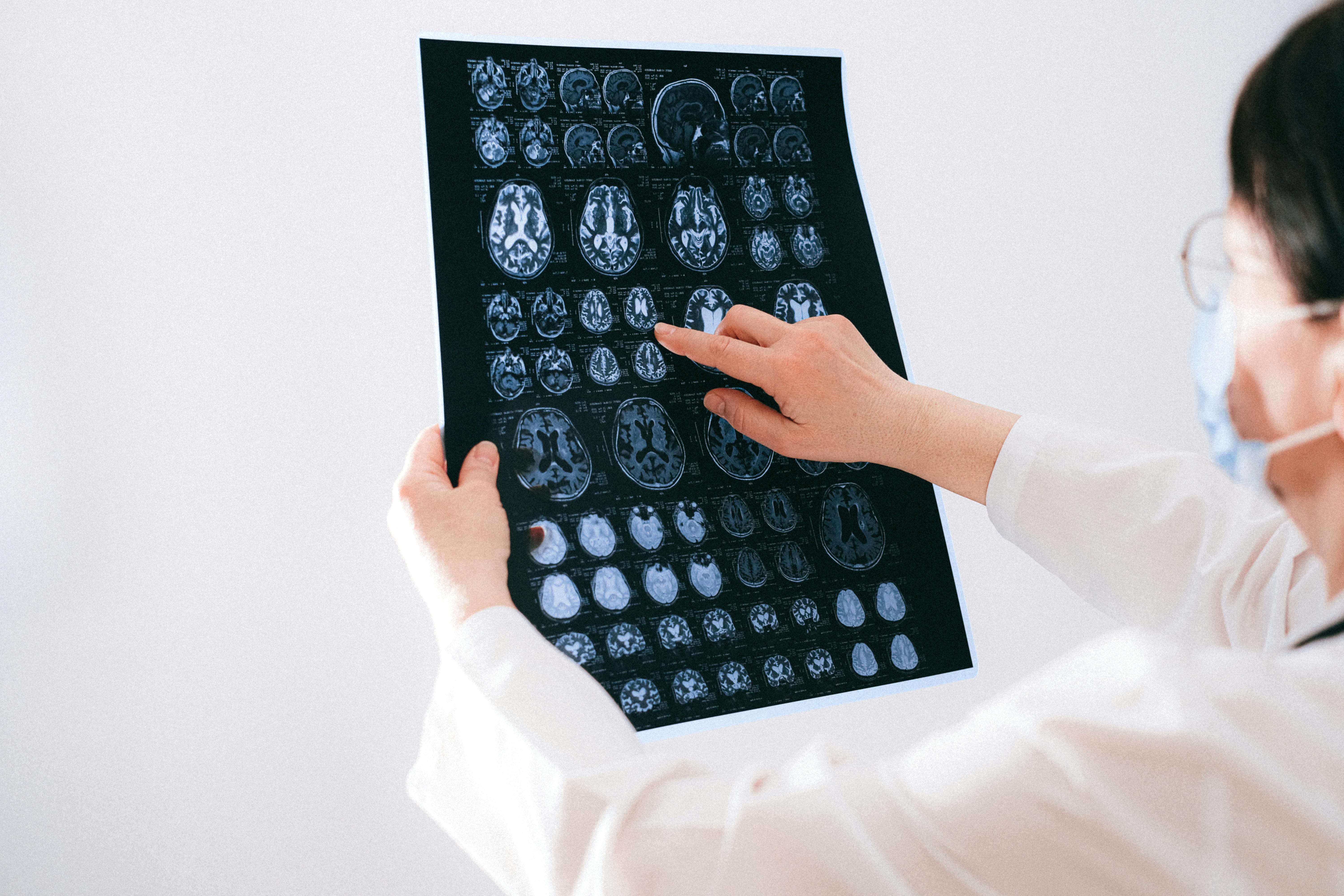 Neurogenesis and Cannabis Research