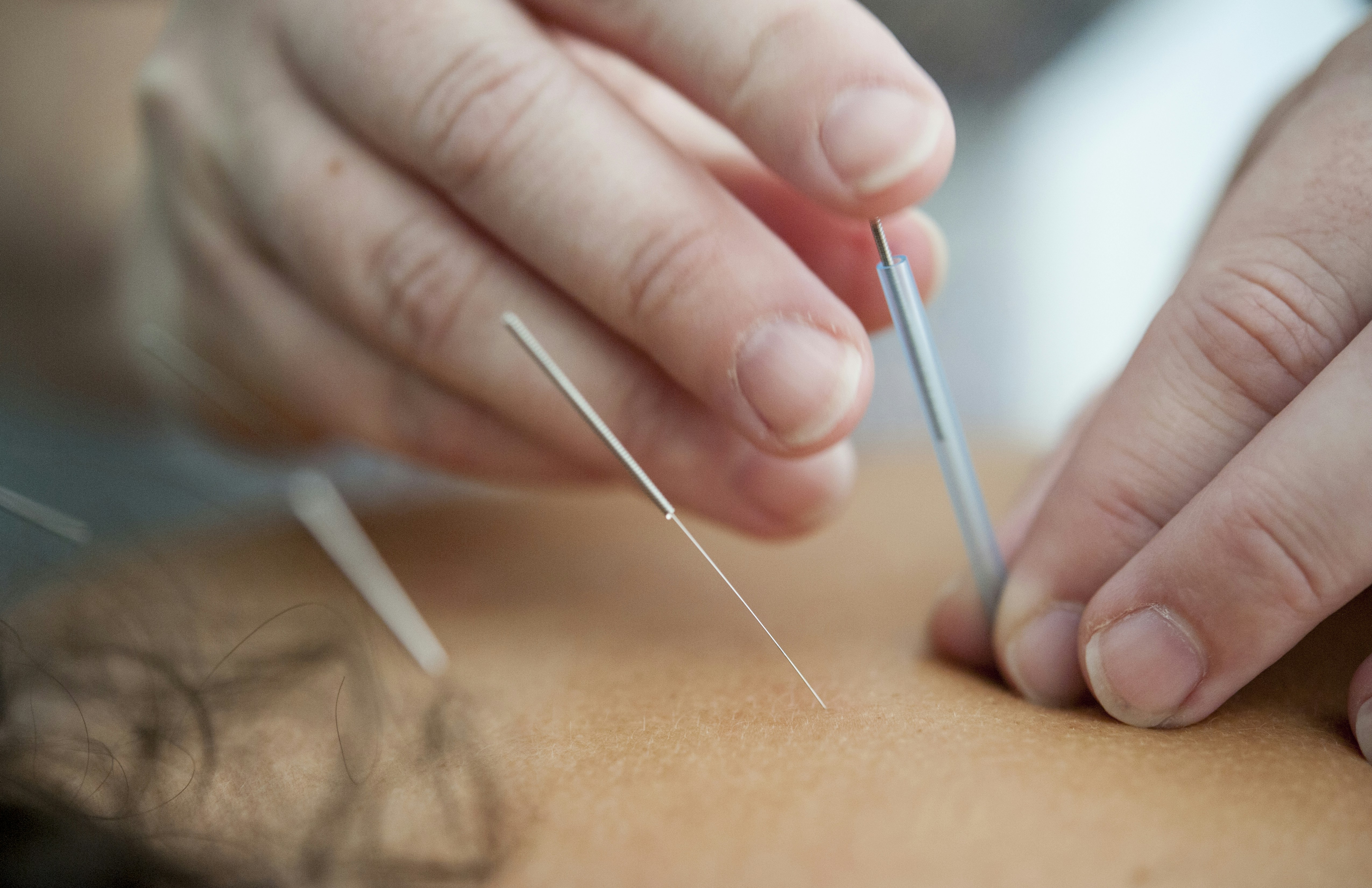 Pain Management and Cannabis